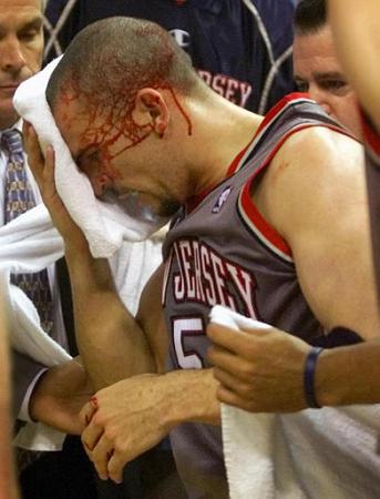 This New Jersey player is bloodied, moments before his team is dispatched. (2002 NBA Playoffs)